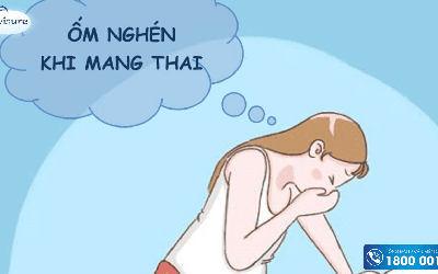 1001 các kiểu nghén khi mang thai 